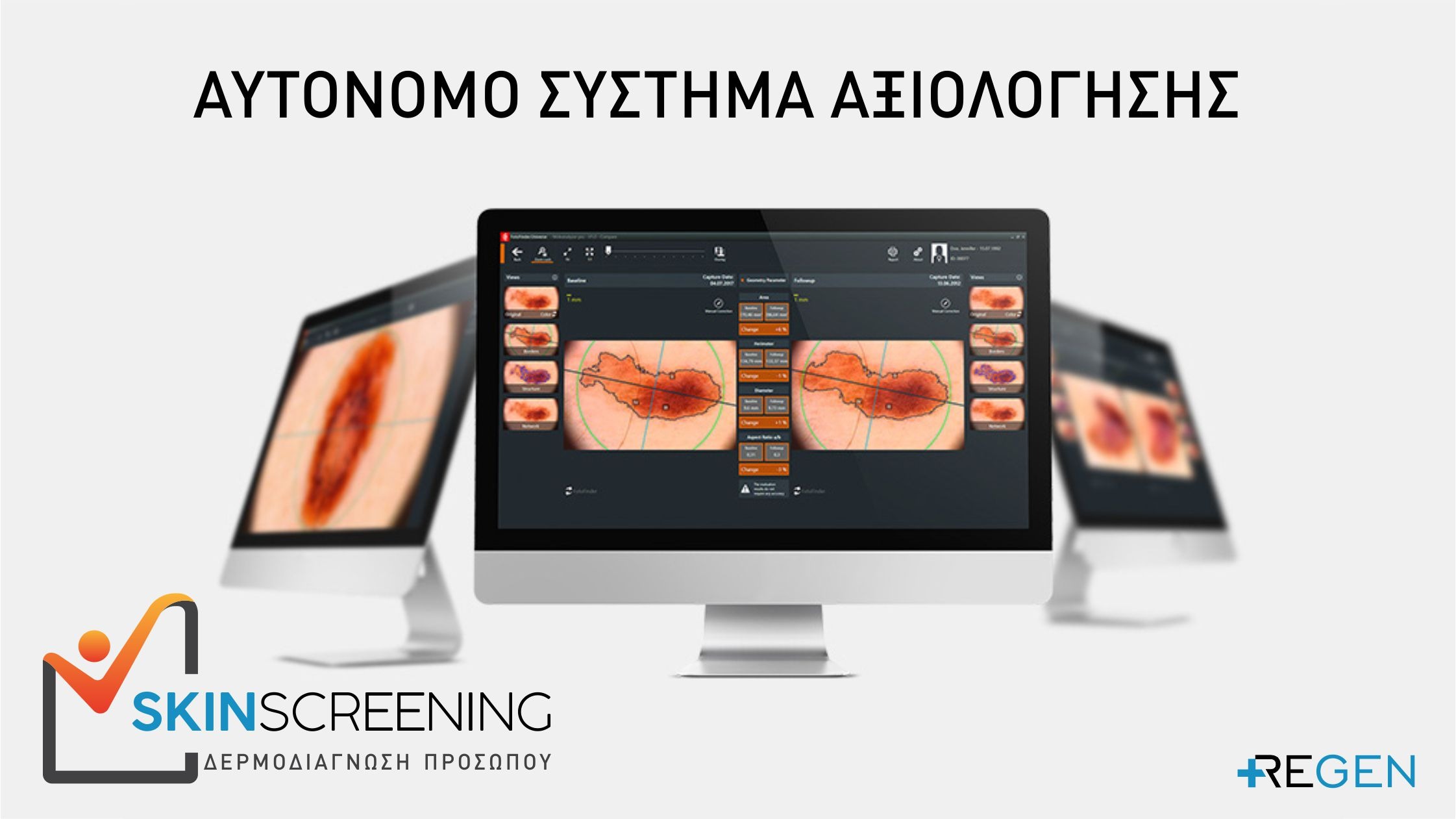 Δερμοδιάγνωση Προσώπου